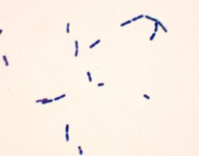 セレウス菌の写真